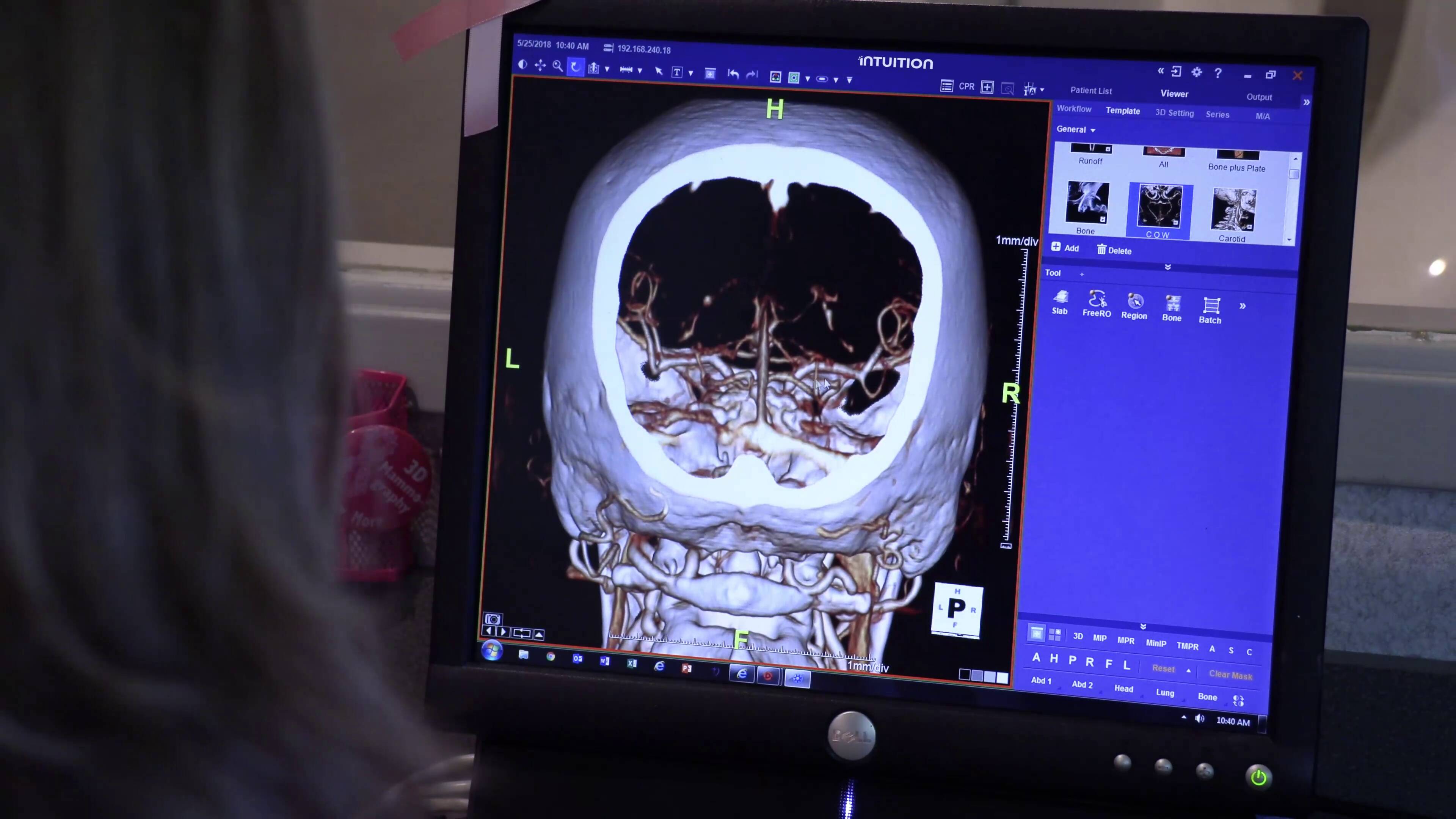 The Future Of Imaging: Undress Free AI